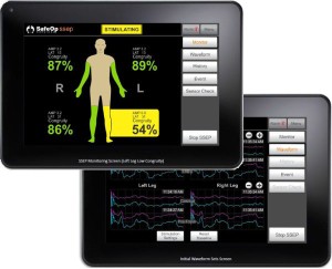 Evoked-Potential-Assessment-Device