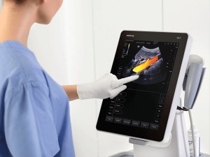 Touchscreen Point of Care Ultrasound with TEE